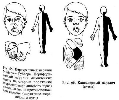 нейрон нейрон