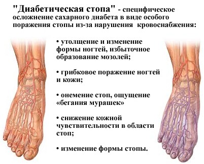 диабет диабет