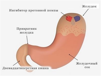 болезнь