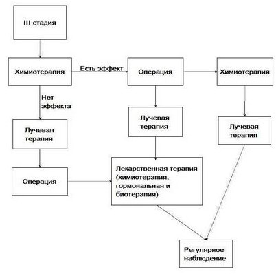мастэктомия мастэктомия