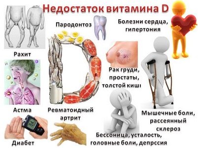 витамин витамин