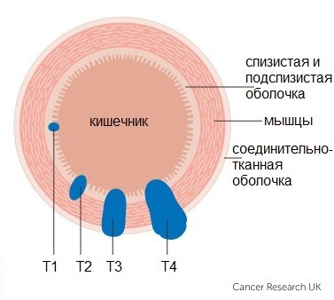 исследование