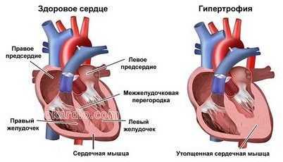 донор донор