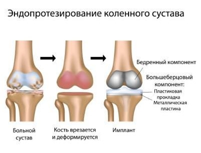 Бесплатной медицинской